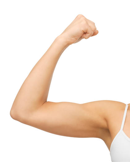 Brachioplasty showing removal of excess skin and refined arm contour