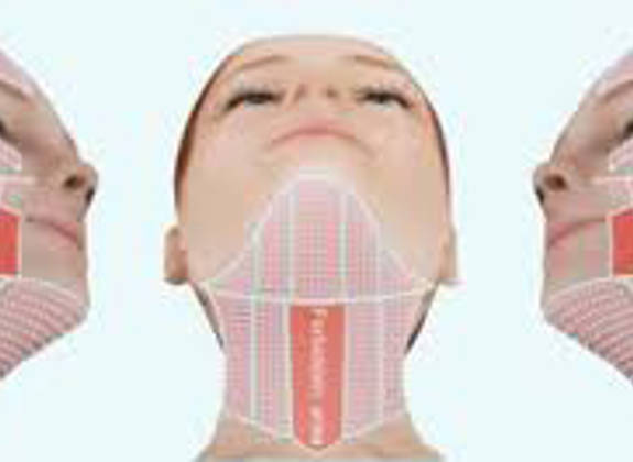 Diagram showing Hifu facial treatment areas on the cheeks and neck for skin tightening and lifting