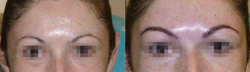 Before and after micropigmentation on the eye area