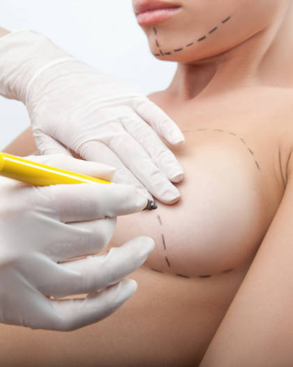 Plastic surgeon marking breast area before augmentation surgery with precision planning