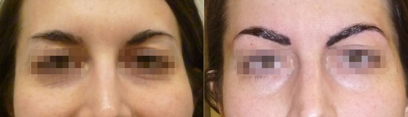 Before and after eyebrow micropigmentation showing brow shape and fresh pigment application