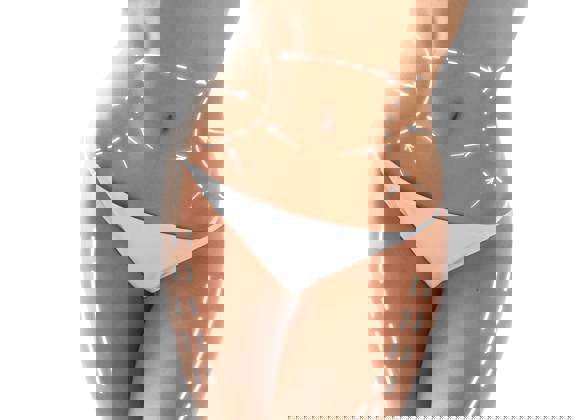 Illustration of body contouring treatment areas with white guide lines of abdomen, waist, and thighs