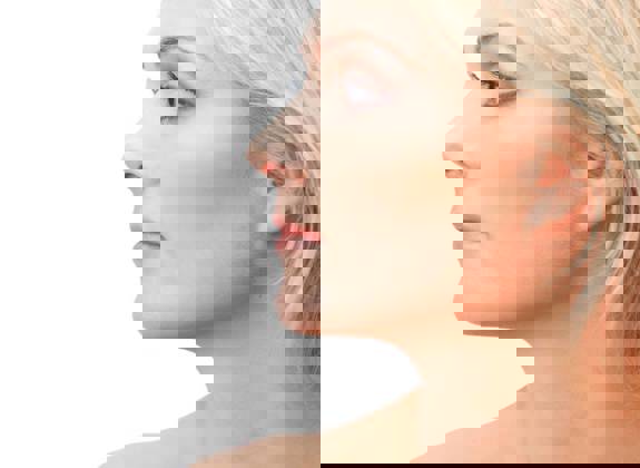 Profile portrait of a blonde woman with smooth skin and balanced nose shape after rhinoplasty