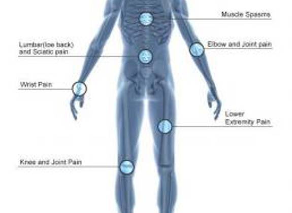 Human body diagram highlighting common areas treated with shockwave therapy