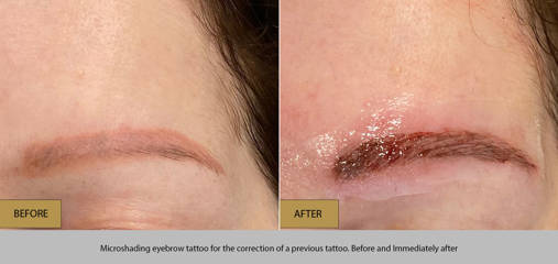 Before and after microshading eyebrow tattoo for the correction of a previous tattoo