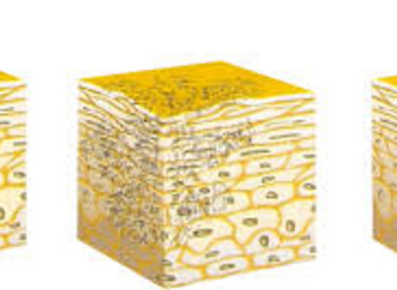 Illustration showing skin layers before, during, and after Q-Switch laser treatment, depicting skin renewal process