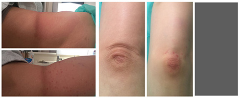 Face lift με νήματα